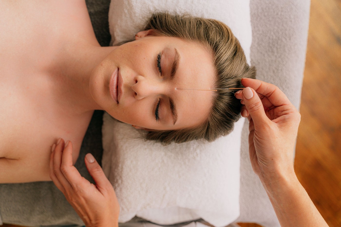 Acupuncturist placing a facial acupuncture needle between a patient's eyebrows
